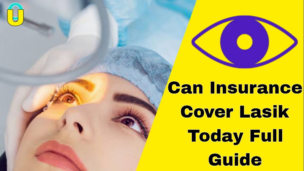 Can Insurance Cover LASIK - Today Full Guide